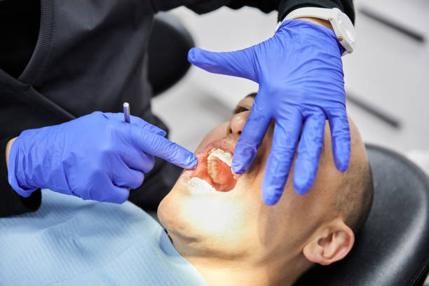 Best Urgent Care for Lost Fillings or Crowns in Brinckerhoff, NY